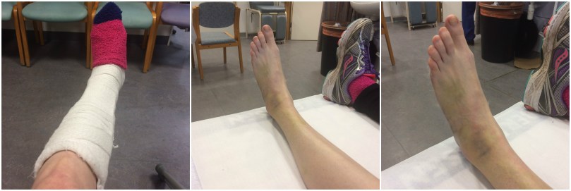 Though the swelling has gone down!